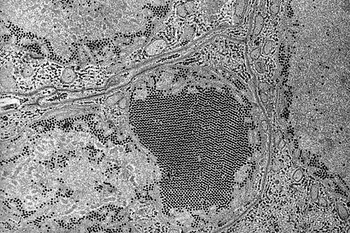 
                    An election micrograph of the St. Louis encephalitis virus.
                                            (Centers for Disease Control and Prevention)
                                        