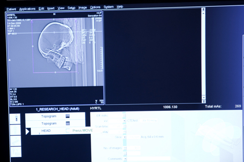 
                    A CAT scan image of a 19th-century skull.
                                            (Todd Vachon/WHYY)
                                        